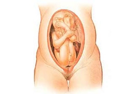 Ngôi thai ngược - những điều cần biết - Mẹ mang thai - Chuẩn bị sinh con - Những điều cần biết khi mang thai