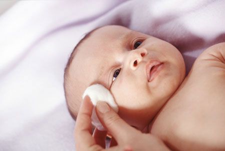 Vệ sinh mắt cho trẻ sơ sinh và những lưu ý - Chăm sóc bé - Bệnh về mắt ở trẻ em - Chăm sóc trẻ sơ sinh