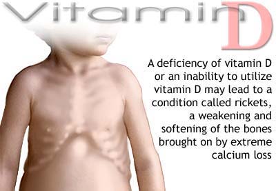 Vitamin D cho bé