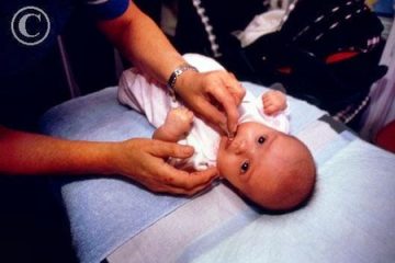Uống bổ sung vaccine phòng bại liệt đối với trẻ dưới 5 tuổi