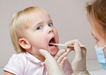 Loét miệng xảy ra quanh năm ở trẻ nhỏ.