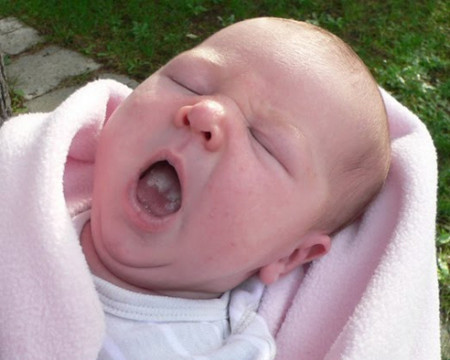  Tưa lưỡi thực chất là 1 loại nấm vì thế các mẹ cần phải cho bé đi khám và dùng thuốc cẩn thận
