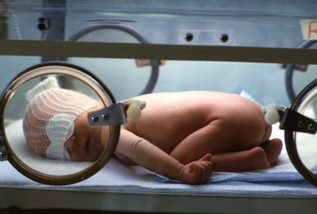 Trẻ sinh non có thể gặp nhiều rủi ro mắc bệnh về đường hô hấp. 