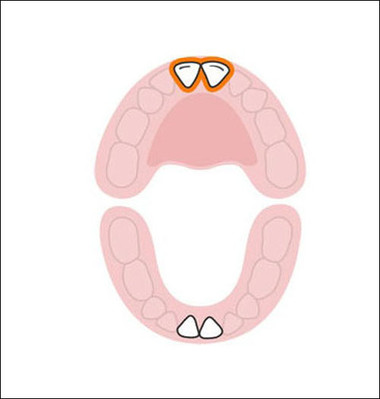 Xuất hiện tiếp theo là 2 chiếc răng cửa trên thường mọc vào tháng thứ 8-12. Khi 2 chiếc răng thỏ này mọc, trông bé nhà bạn rất dễ thương.