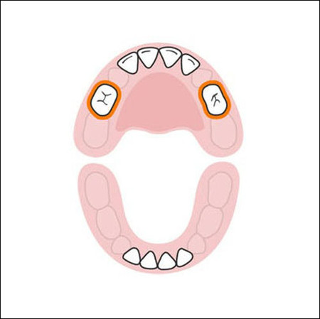 Hai chiếc răng hàm trên đầu tiên xuất hiện khi bé 13-19 tháng tuổi. Hai chiếc răng này mọc ở vị trí lùi về phía trong, cách một vị trí so với 4 chiếc răng cửa trên đầu tiên.