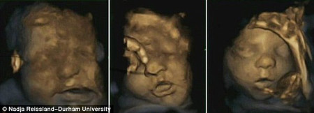 Loạt ảnh 4D cho thấy bé thực hành các trạng thái khuôn mặt để có thể giao tiếp với cha mẹ sau sinh.