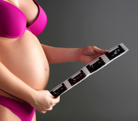  Có những dạng dị tật chỉ được phát hiện qua siêu âm vào một thời điểm nhất định của thai kỳ. 
